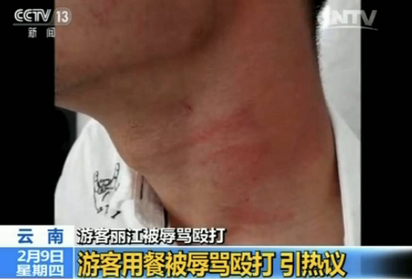 游客麗江就餐被辱罵毆打 真相到底是什么？