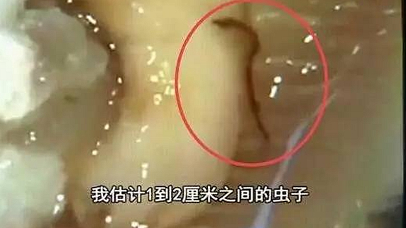 一只生蠔引起的冤案，觸動了餐飲人的“麻木神經(jīng)”